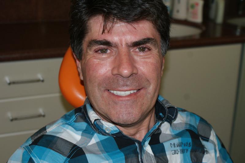 Lou Australia , Full upper  & Lower implants Done